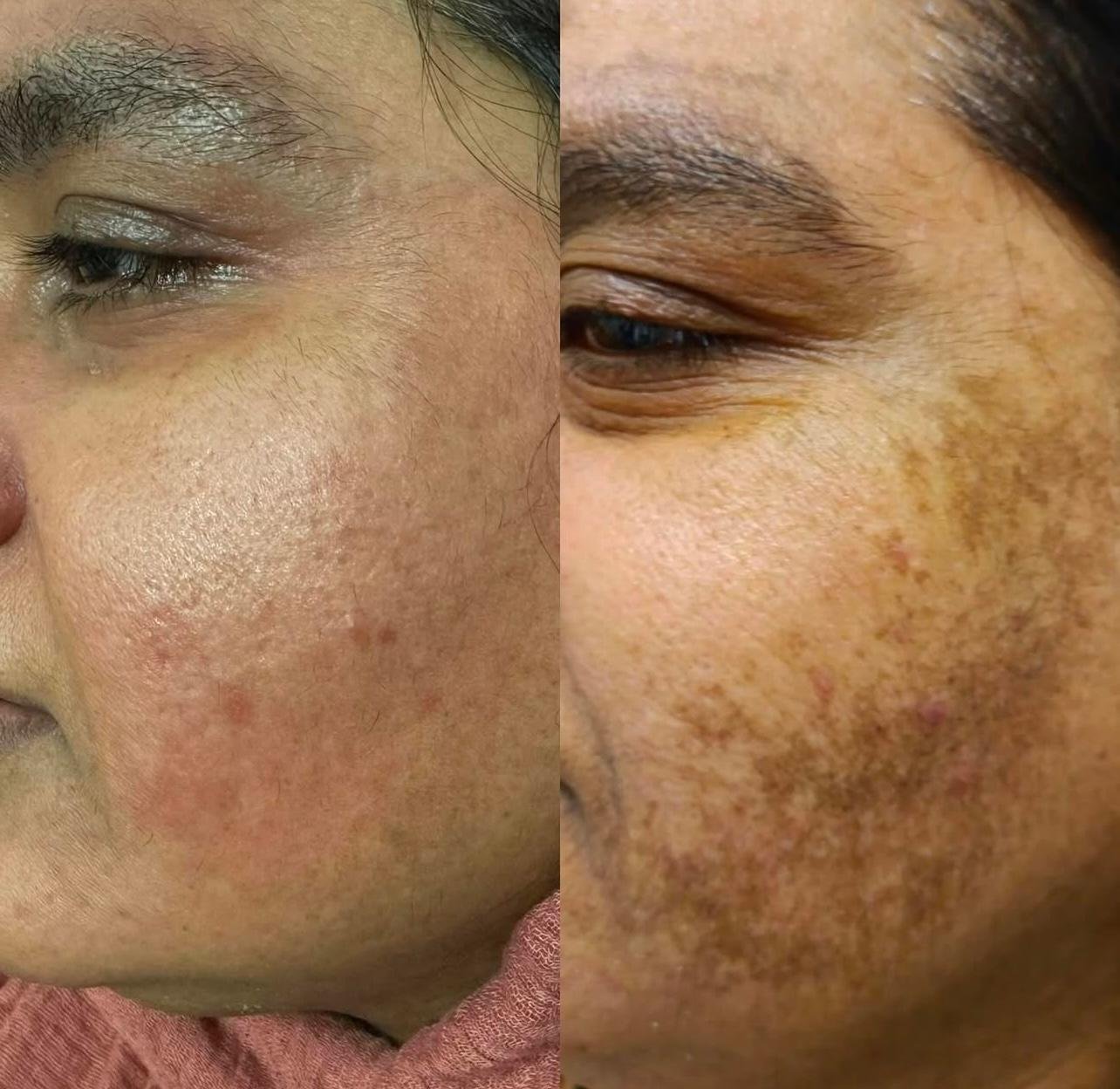 Mobile Derma
