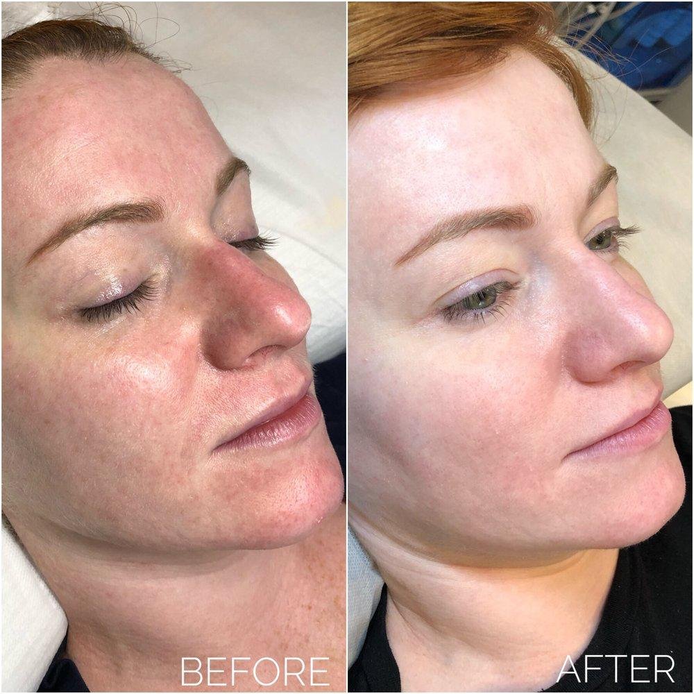 Mobile Derma